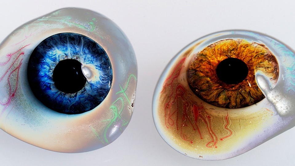 Thay mắt giả hết bao nhiêu tiền? Cấu tạo của mắt giả ra sao?