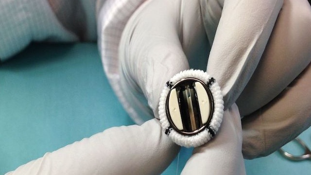 Thay van tim ở bệnh viện nào tốt nhất 1