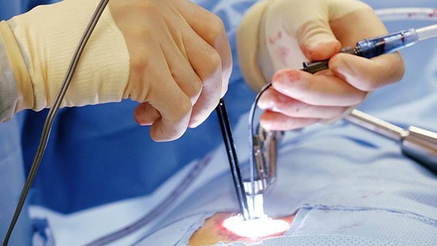 Thay van tim ở bệnh viện nào tốt nhất 3