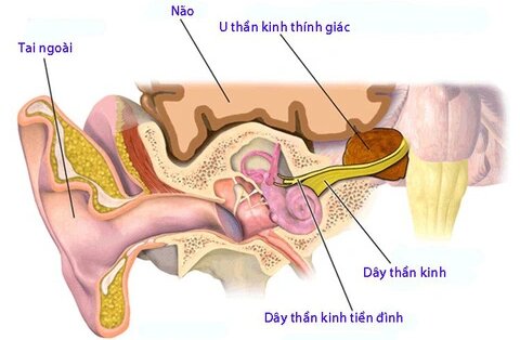 Thính giác là gì? Cấu tạo và cơ chế hoạt động của hệ thính giác 3