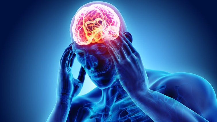 Thoát vị não là gì? Những vấn đề cần biết về Thoát vị não 1.jpg