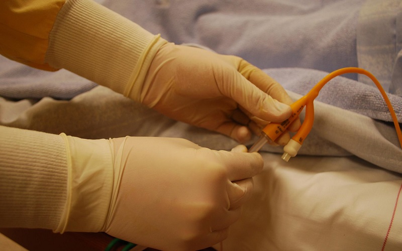 Thời gian lưu sonde tiểu tối đa là bao lâu? 1