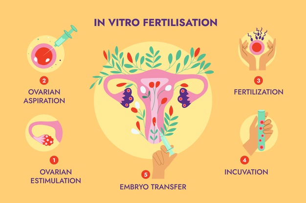 Thụ tinh ống nghiệm (IVF): Niềm hy vọng cho các cặp vợ chồng hiếm muộn 3