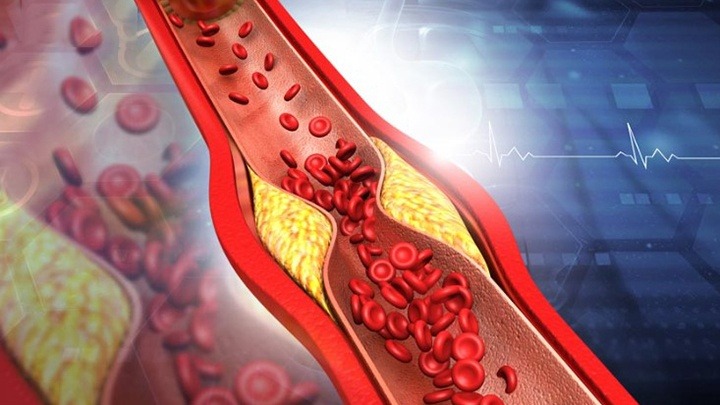 thuc-don-an-gao-lut-co-giam-mo-mau-khong 2.jpg