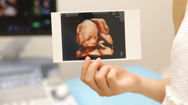 Thực hư bà bầu uống bia cho con trắng ra sao? 4