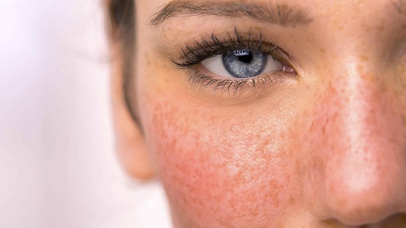 thuoc-alpha-ktal-la-gi-mot-so-luu-y-khi-su-dung-thuoc 3