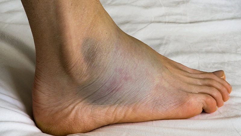 Thuốc Katrypsin có phải là kháng sinh không? Thuốc có công dụng gì? 3