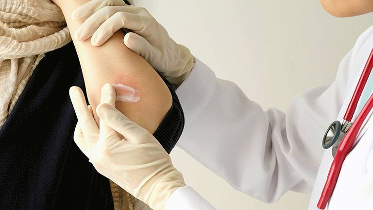 thuoc-mo-la-gi-thuoc-mo-khang-sinh-co-tac-dung-gi 3.jpg