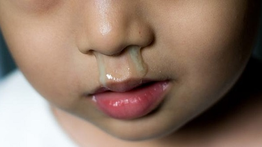 thuoc-nho-mui-khang-sinh-co-nhung-loai-nao-truong-hop-nao-can-dung-thuoc-nho-mui-khang-sinh-cho-tre 2