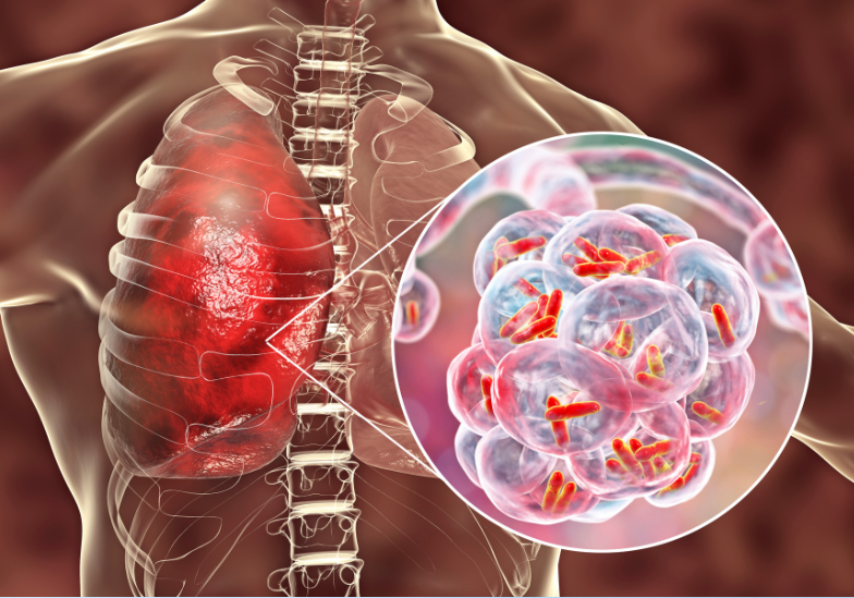 Thủy đậu bị mấy lần trong đời? Giải đáp thắc mắc về bệnh thủy đậu 4