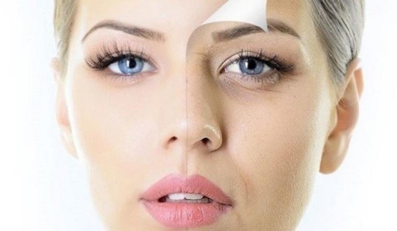 Tiêm filler hốc mắt có nguy hiểm không? Những thông tin cần biết 2