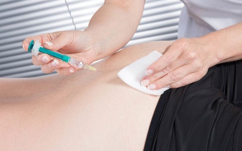 Tiêm filler mông có tập gym được không? Một số lưu ý cần biết 1