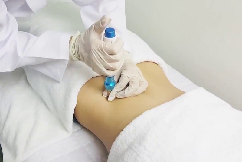 Tiêm tan mỡ là gì? Có an toàn không? 3