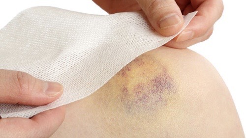 tiem-huyet-tuong-giau-tieu-cau-nhieu-co-tot-khong 3