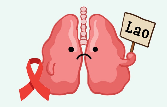 Tiêm phòng lao: Bước đi quan trọng trong cuộc chiến phòng chống bệnh lao 1