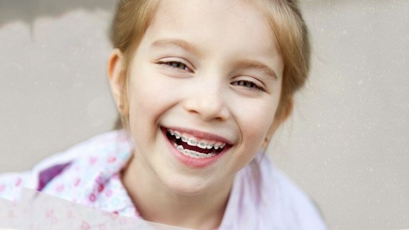 tien-chinh-nha-giai-phap-cho-nu-cuoi-rang-ro-cho-be 3