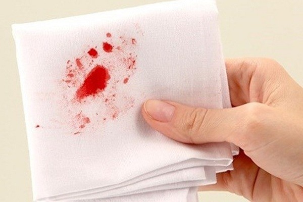 tieu-cau-giam-con-90-co-nguy-hiem-khong 1.jpg