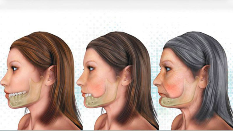 Tiêu xương hàm có trồng răng được không? 1