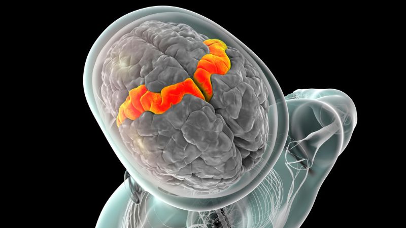 Vỏ não vận động bị ảnh hưởng như thế nào khi bị đột quỵ?1