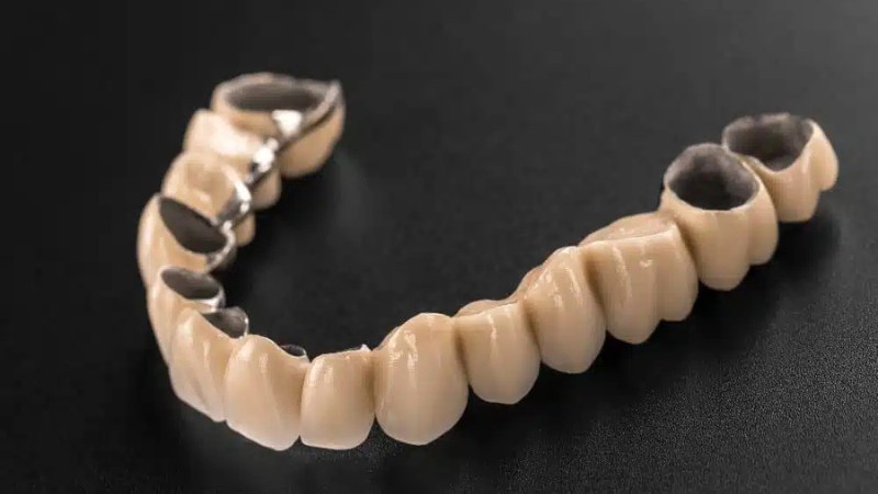 Tìm hiểu bọc răng sứ 2 răng cửa bao nhiêu tiền 3