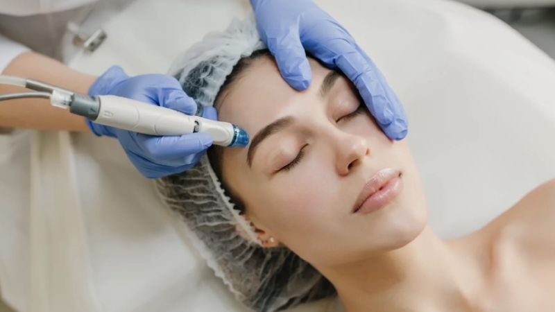 Tìm hiểu cấy collagen tươi giá bao nhiêu và giải pháp thay thế 1