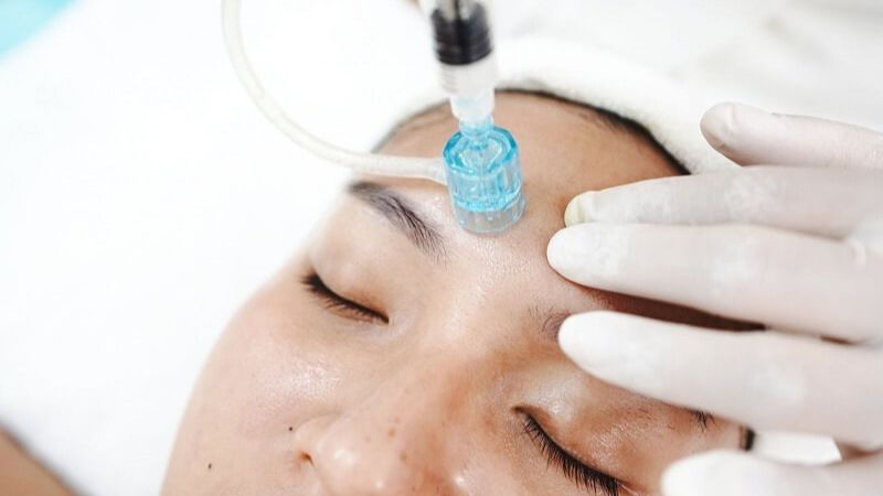 Tìm hiểu cấy collagen tươi giá bao nhiêu và giải pháp thay thế 3