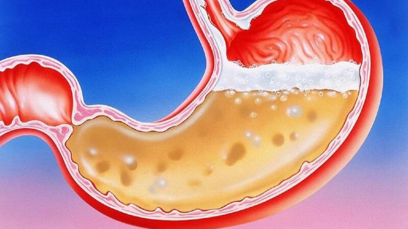 Tìm hiểu dạ dày được cấu tạo bởi mấy lớp cơ bản và bệnh lý thường gặp 3