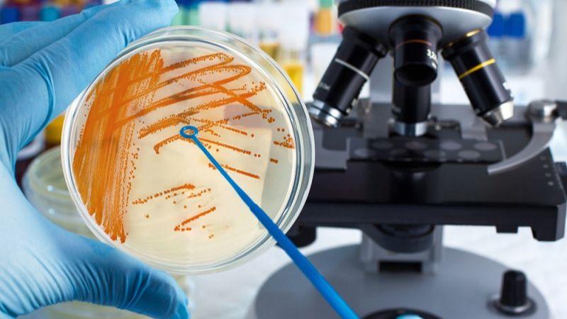 Tìm hiểu một số môi trường nuôi cấy vi khuẩn 2