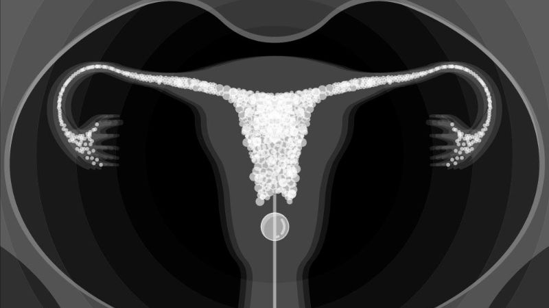 Tìm hiểu quy trình chụp HSG buồng tử cung và vòi trứng 2