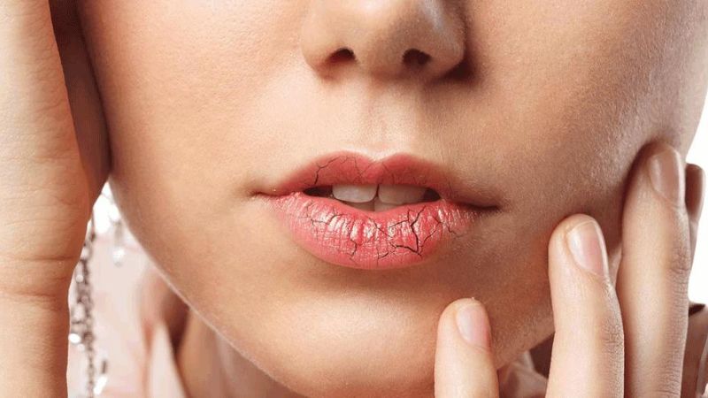 Tìm hiểu về bệnh lý sỏi tắc nghẽn ống wharton 2