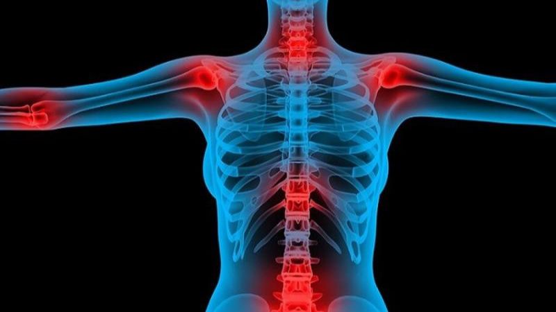 Tìm hiểu về bệnh osteosarcoma xương (ung thư xương) 3