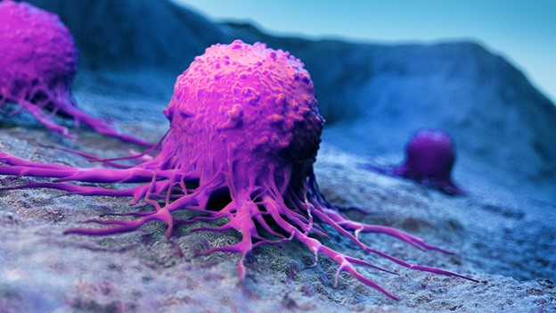 Tìm hiểu về các loại xét nghiệm dấu ấn ung thư thường được sử dụng 1