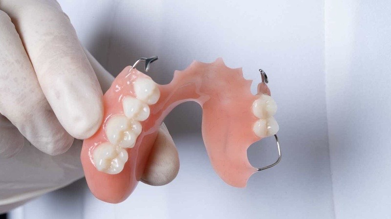 tim-hieu-ve-ham-khung-thao-lap-kim-loai-va-nhung-dieu-can-luu-y 1