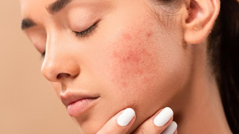 Tìm hiểu về hoạt chất galactomyces trong sản phẩm chăm sóc da 4