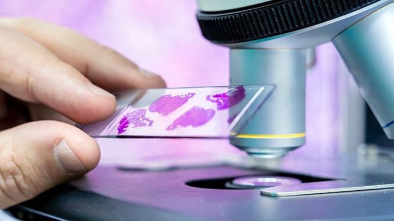 Tìm hiểu về kỹ thuật nhuộm hóa mô miễn dịch trong điều trị ung thư 3