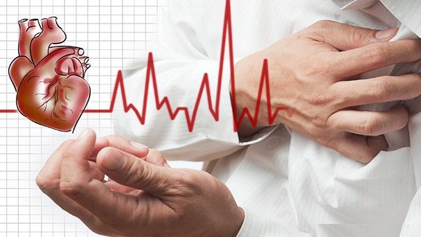Tìm hiểu về nhồi máu cơ tim bán cấp 1