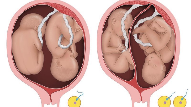 tim-hieu-ve-song-thai-nhung-rui-ro-va-luu-y-cho-me-va-be 1