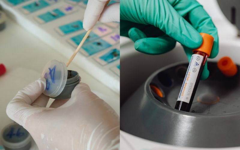 Xét nghiệm bất dung nạp lactose ở trẻ sơ sinh bao gồm xét nghiệm máu và xét nghiệm phân