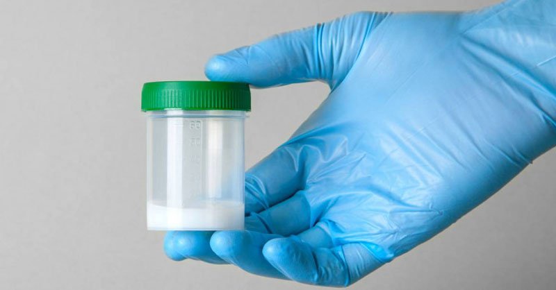 Tinh trùng có bọt có phải bình thường không? 2