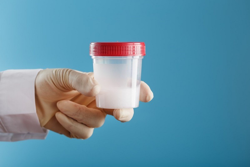 Tinh trùng của đàn ông lâu ngày không quan hệ như thế nào? 3