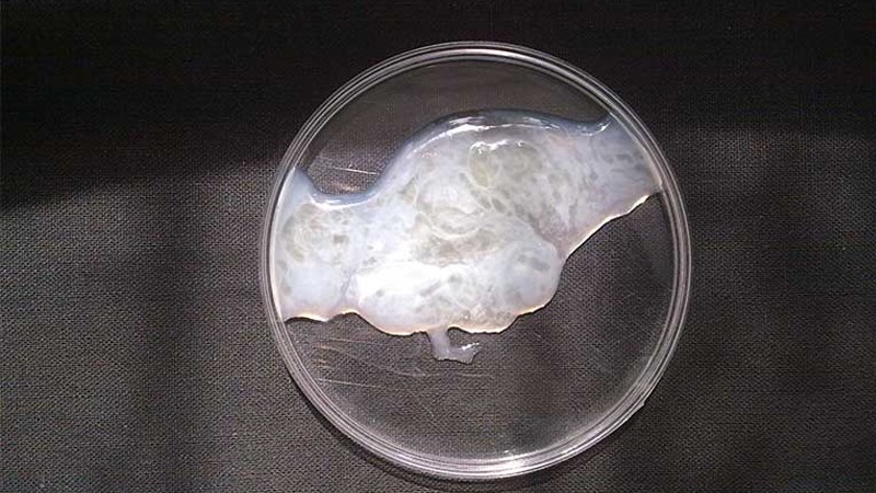 Tinh trùng là gì? Những điều quan trọng cần biết 2