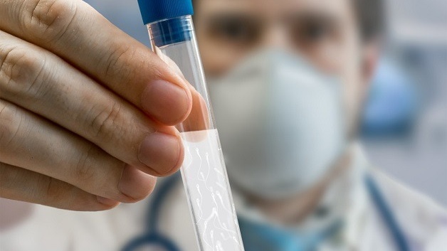 Tinh trùng sau khi lọc rửa sống được bao lâu? 2