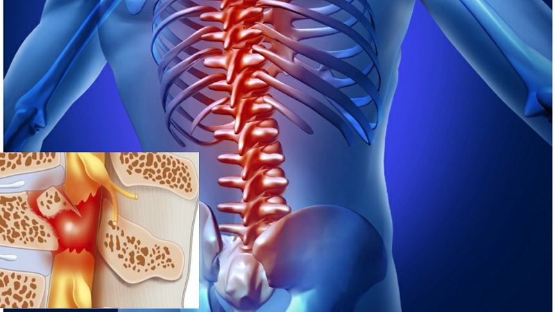 Tổn thương tủy sống có thể chữa được không? 1