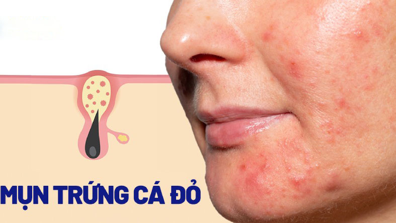 Tổng hợp các vấn đề về da thường gặp nhất ở người lớn 2