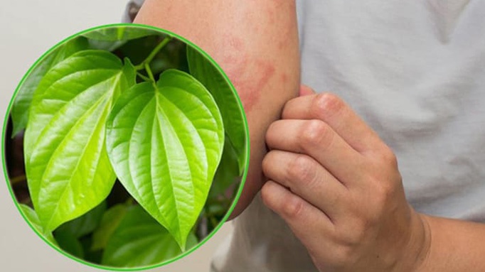 Top 3 cách trị ghẻ nước bằng lá trầu không 2