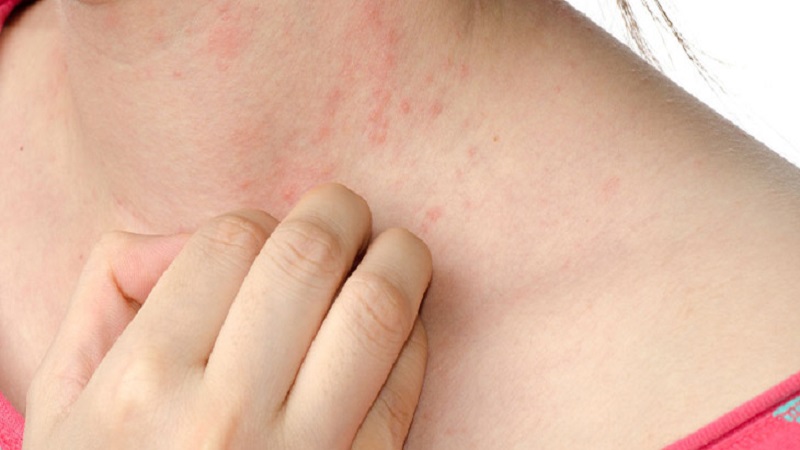 Trà masala chai là gì? Những lợi ích sức khỏe ai cũng bất ngờ của thức uống này 5