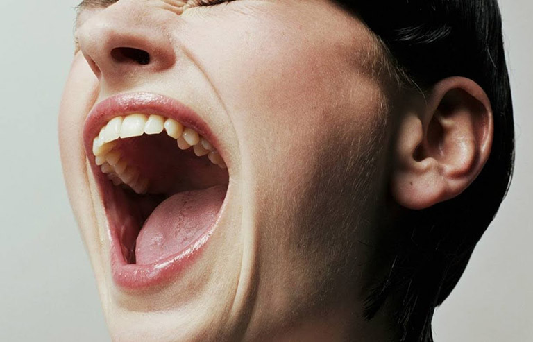 Trật khớp hàm: Biểu hiện, nguyên nhân, điều trị và cách phòng ngừa 2