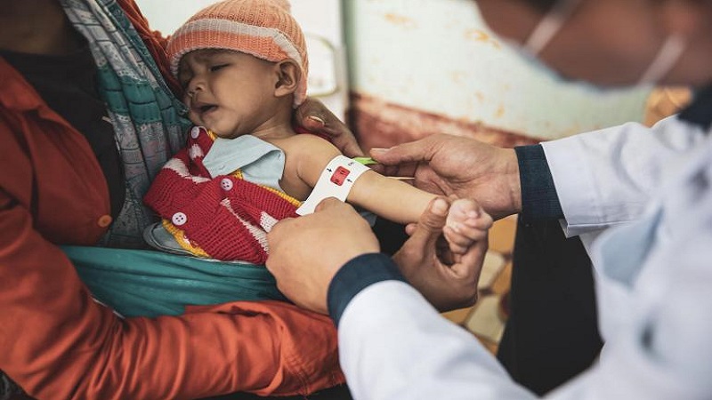 Trẻ suy dinh dưỡng nặng và những thông tin cần quan tâm 3