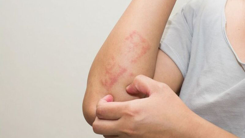 Triệt lông tay vĩnh viễn và những điều cần biết 3