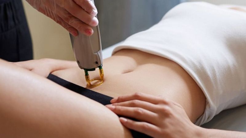 Tác hại của triệt lông vùng kín bạn nên biết  2